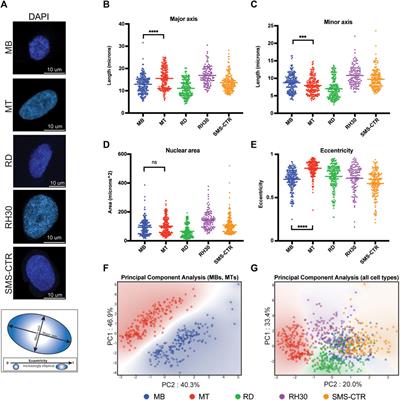 Differentiation-dependent chromosomal organization changes in normal myogenic cells are absent in rhabdomyosarcoma cells